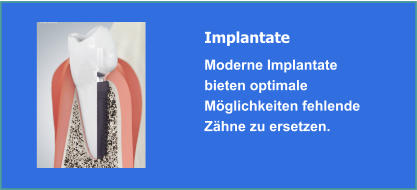 Implantate und Implantologie