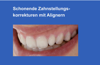 Schonende Zahnstellungs-korrekturen mit Alignern
