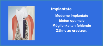 Implantate und Implantologie