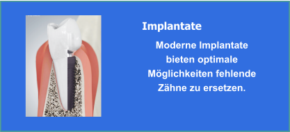 Implantate und Implantologie