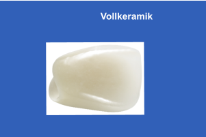 Vollkeramik