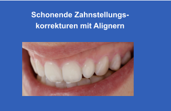 Schonende Zahnstellungs-korrekturen mit Alignern