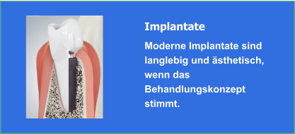 Implantate und Implantologie