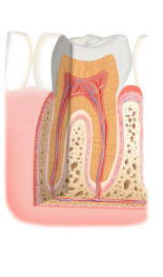 gesunder Zahn Celle